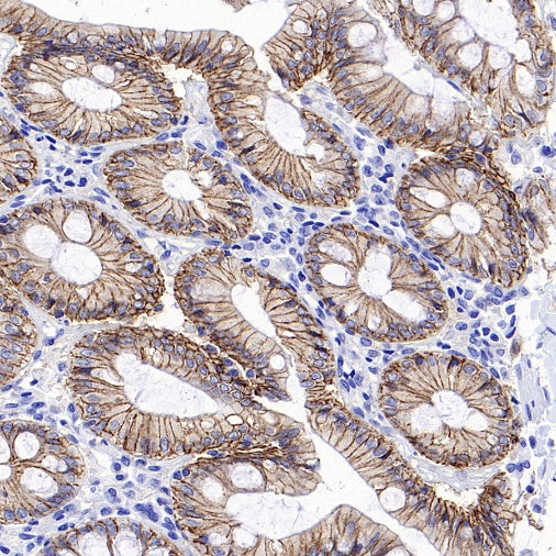 Non-phospho (Active) β-Catenin (Ser37/Thr41) Recombinant Rabbit mAb (S-1813-42)