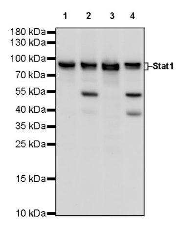 Stat1 Recombinant Rabbit mAb (S-559-91)
