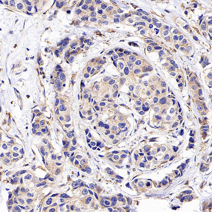 SEC24D Rabbit Polyclonal Antibody