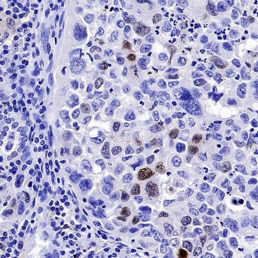 Survivin Recombinant Rabbit mAb (S-2334-26)