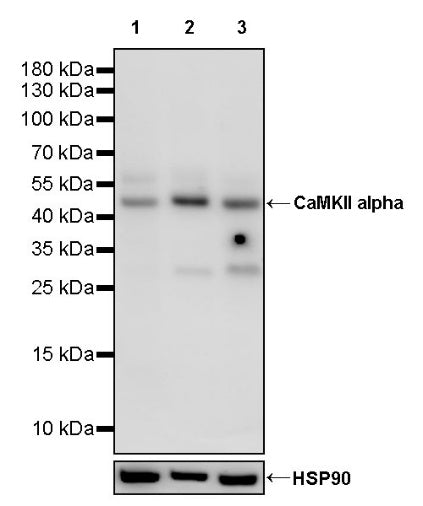 CaMKII alpha Recombinant Rabbit mAb (S-2451-54)