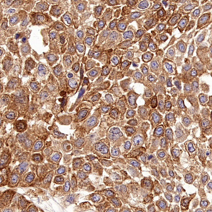 CD112/Nectin-2 Recombinant Rabbit mAb (S-2404-66)