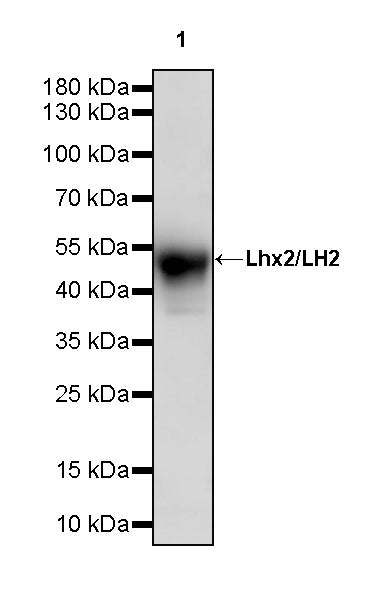 Lhx2/LH2 Recombinant Rabbit mAb (S-3867-28)