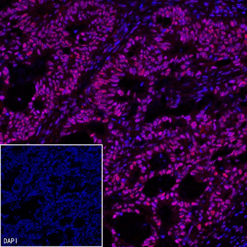 U2AF2 Recombinant Rabbit mAb (S-1324-66)