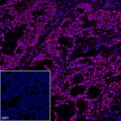 U2AF2 Recombinant Rabbit mAb (S-1324-66)