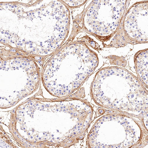 Collagen VI (COL6A1) Recombinant Rabbit mAb (S-1495-18)