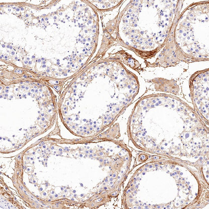 Collagen VI (COL6A1) Recombinant Rabbit mAb (S-1495-18)