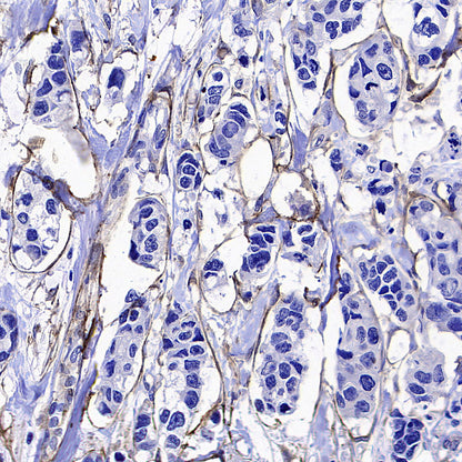 Fibroblast Activation Protein alpha/FAP Recombinant Rabbit mAb (S-3998-2)