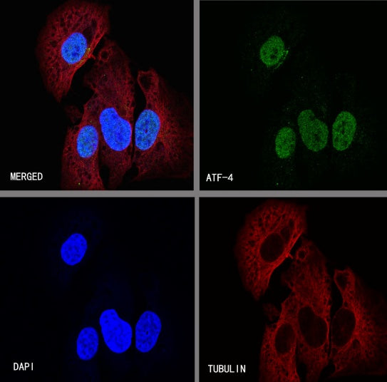 ATF-4 Recombinant Rabbit mAb (S-471-111)