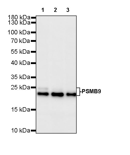 PSMB9 Recombinant Rabbit mAb (S-4183-122)
