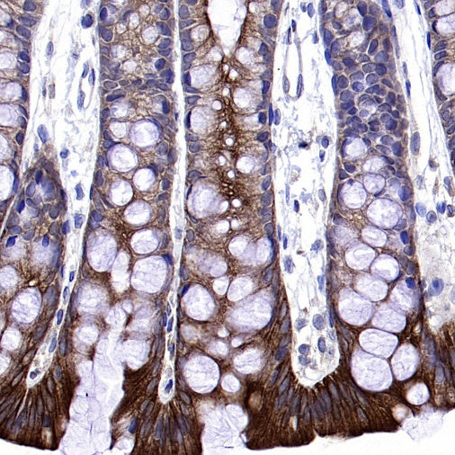 Atg5 Recombinant Rabbit mAb (S-3181)