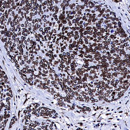 Lamin A/C Recombinant Rabbit mAb (S-5671)