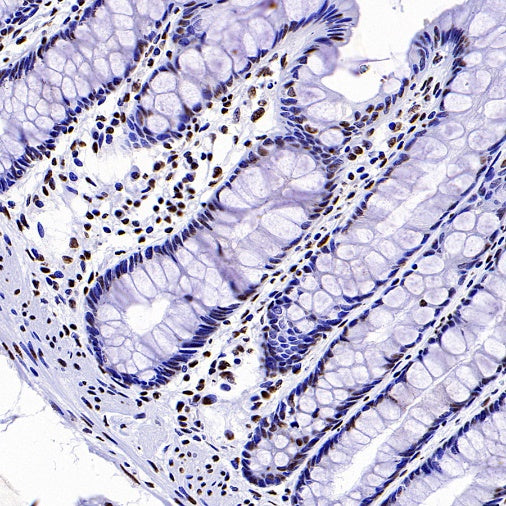Histone H3 (tri methyl K4) Recombinant Rabbit mAb (S-1602-21)