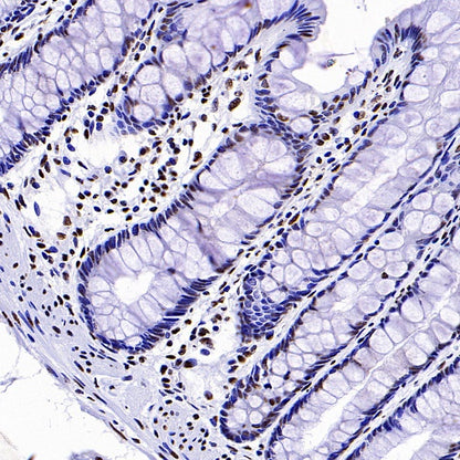 Histone H3 (tri methyl K4) Recombinant Rabbit mAb (S-1602-21)