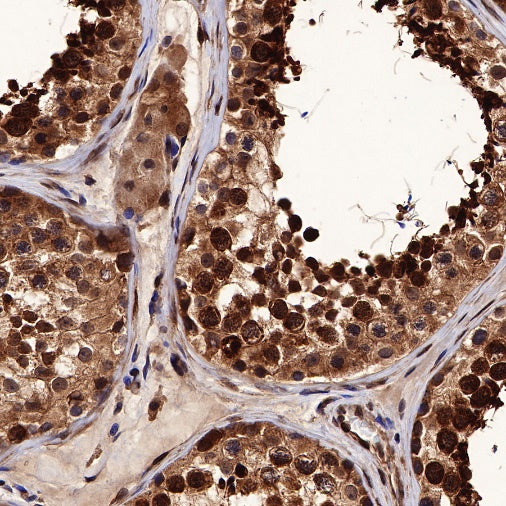 SBDS Recombinant Rabbit mAb (S-R344)