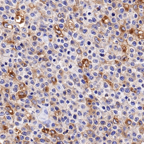 Scavenging Receptor SR-BI Recombinant Rabbit mAb (S-1736-15)