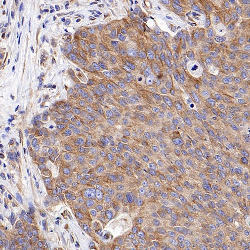 Beta IV Tubulin Recombinant Rabbit mAb (S-1572-30)