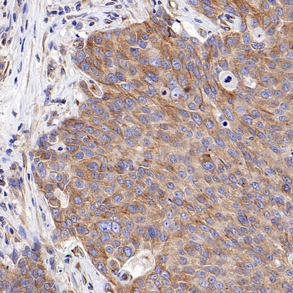 Beta IV Tubulin Recombinant Rabbit mAb (S-1572-30)