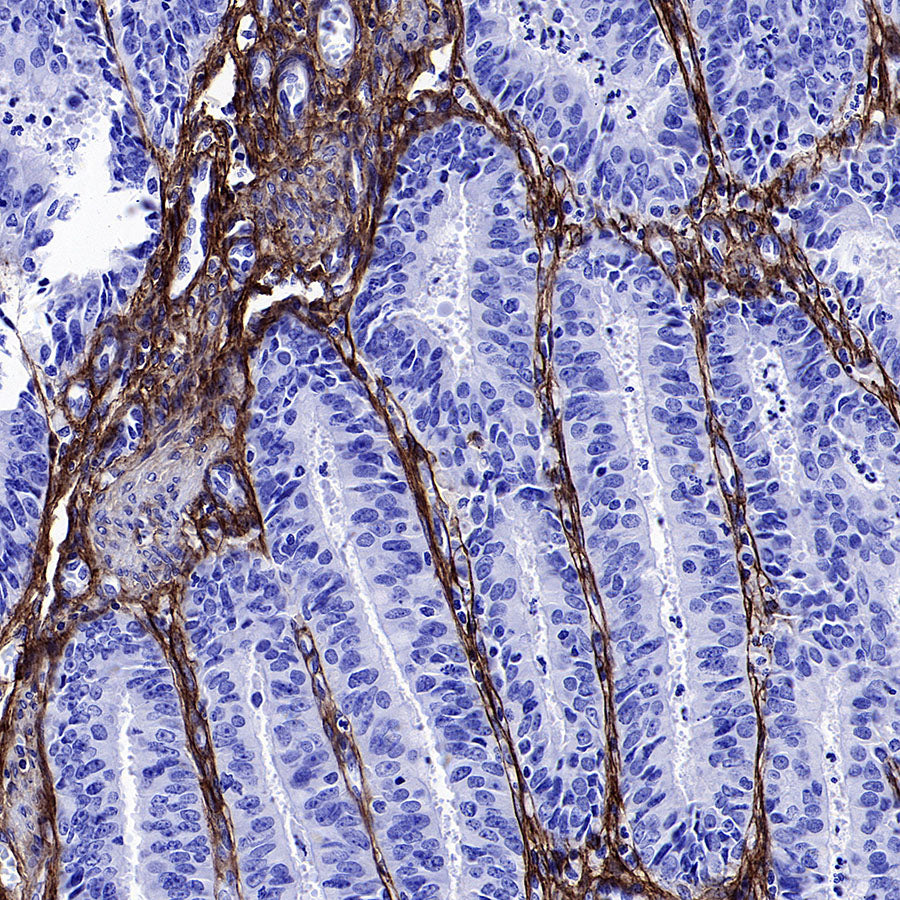 COL3A1 Recombinant Rabbit mAb (S-4338)
