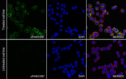 uPAR/CD87 Recombinant Rabbit mAb (S-3960-82)