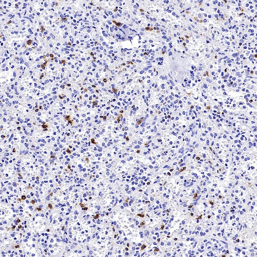 CD94 Recombinant Rabbit mAb (S-2616-5)