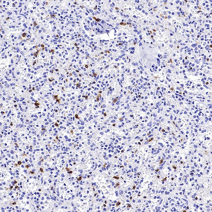 CD94 Recombinant Rabbit mAb (S-2616-5)
