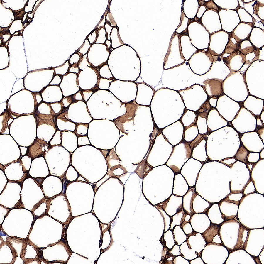 Perilipin-1 Recombinant Rabbit mAb (S-3093-31)