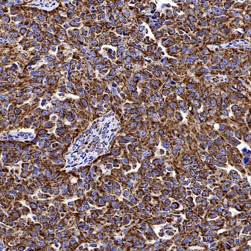 MTCO1 Recombinant Rabbit mAb (S-2205-28)
