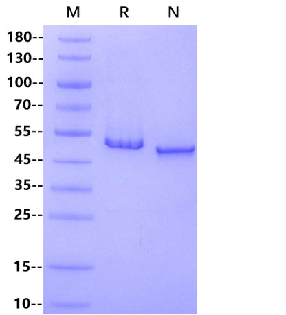 CBLB/RNF56(36-426) His Tag Protein, Human