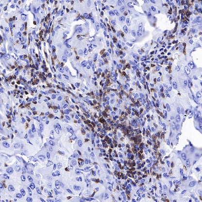 Lck Recombinant Rabbit mAb (SDT-316-15)