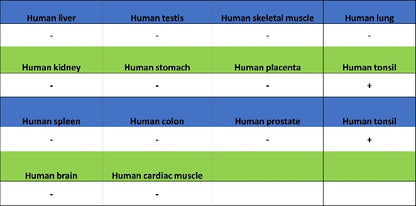 TIGIT Recombinant Rabbit mAb (S-4600)