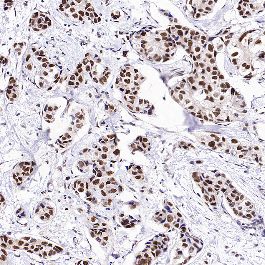 SMARCA3 Recombinant Rabbit mAb (S-3575-154)