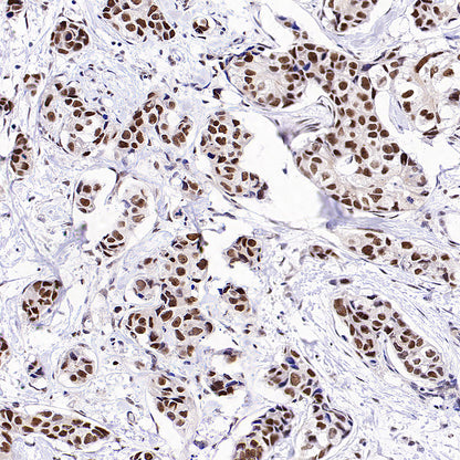 SMARCA3 Recombinant Rabbit mAb (S-3575-154)