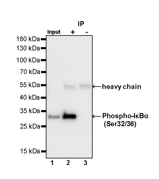 Phospho-IκBα (Ser32/36) Recombinant Rabbit mAb (S-R362)