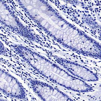 STEAP1+STEAP1B1+STEAP1B2 Recombinant Rabbit mAb (S-3226-137)