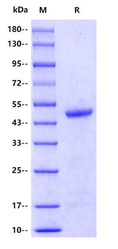 Human RAGE Protein, His tag