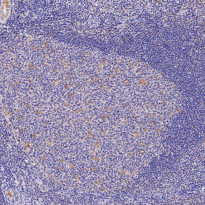 LRP1 Rabbit Polyclonal Antibody