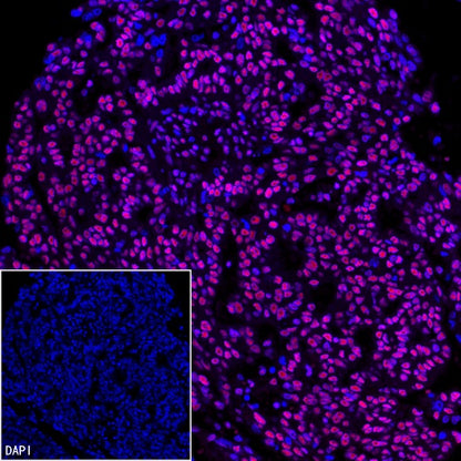 SP1 Recombinant Rabbit mAb (S-3073-71)
