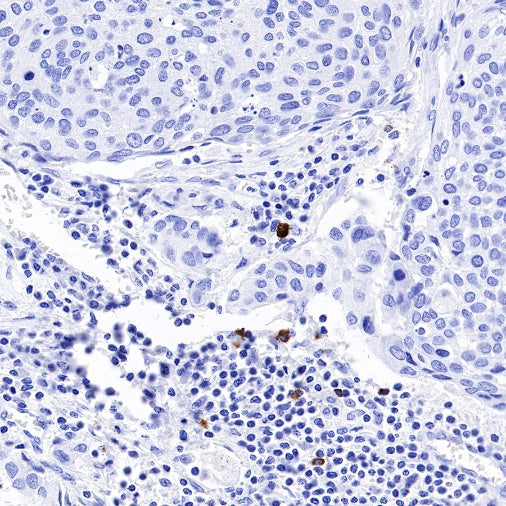 Granzyme B Recombinant Rabbit mAb (S-357-54)