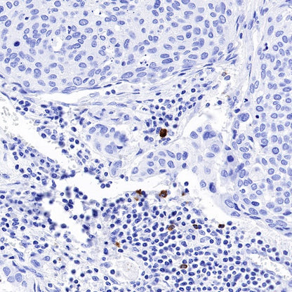 Granzyme B Recombinant Rabbit mAb (S-357-54)