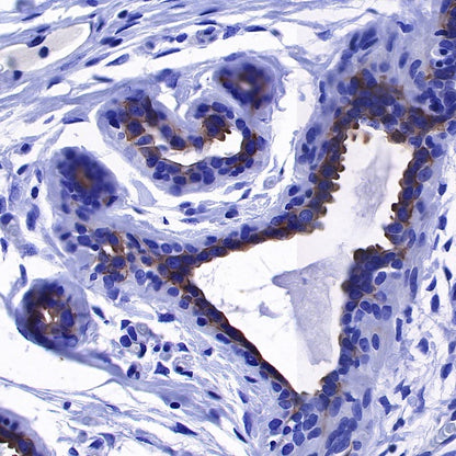 ErbB4 Recombinant Rabbit mAb (S-496-61)