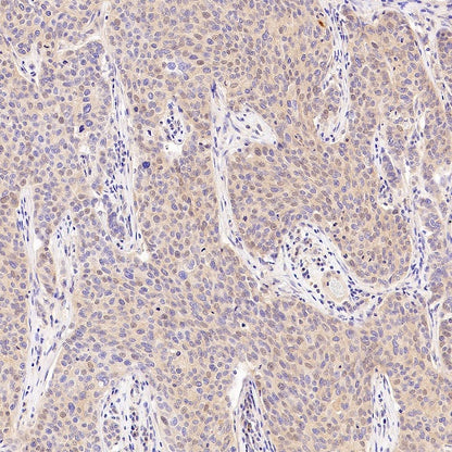 Rab5 Recombinant Rabbit mAb (S-1506-128)