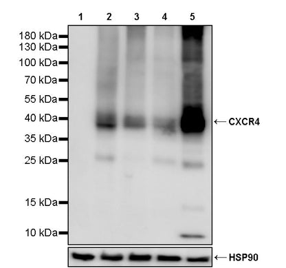 CXCR4 Recombinant Rabbit mAb (S-5318)