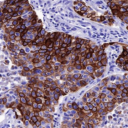 MUC4 Recombinant Rabbit mAb (SDT-R228)