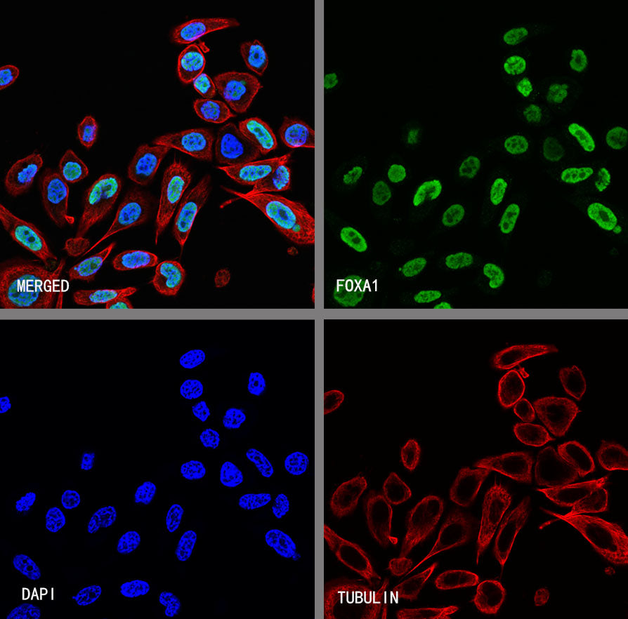 FOXA1 Recombinant Rabbit mAb (S-4339)