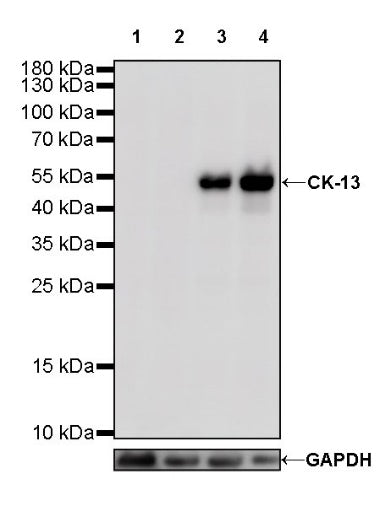 CK-13 Recombinant Rabbit mAb (SDT-641-41)
