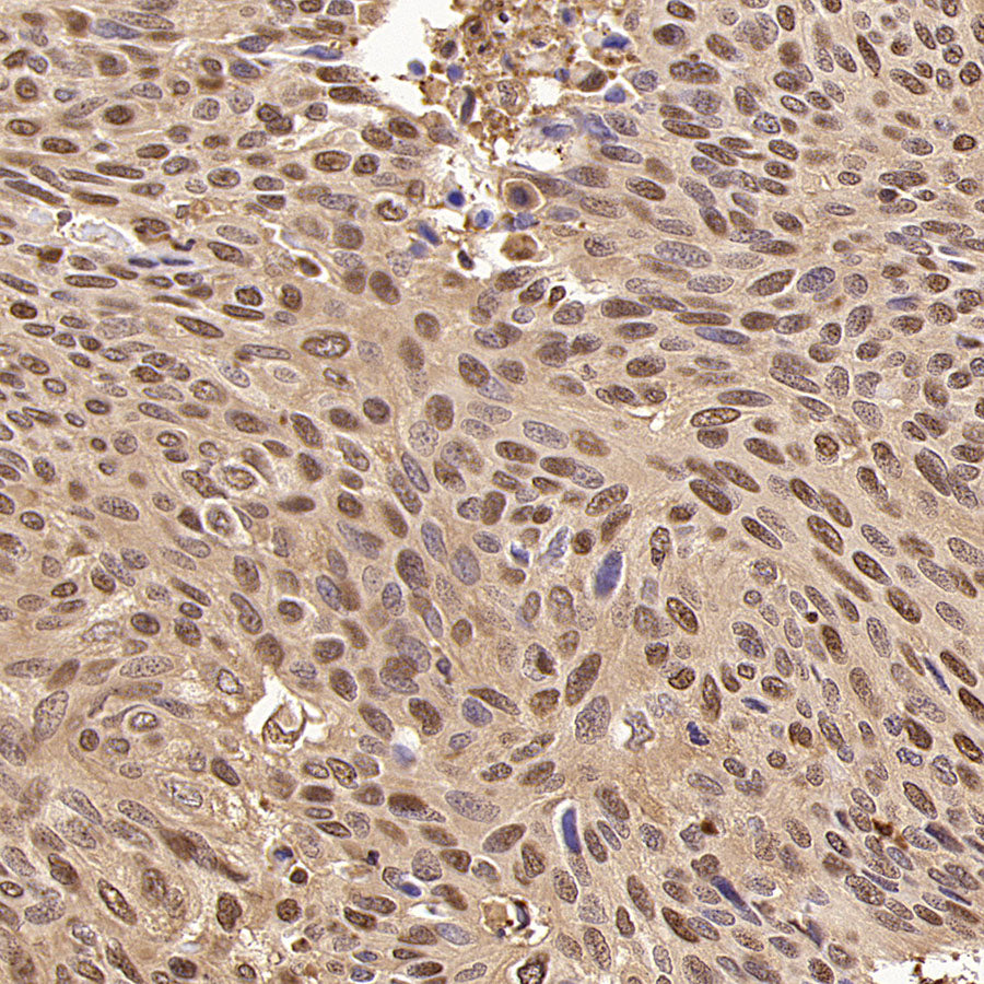 S-RMab® GAPDH Recombinant Rabbit mAb (S-240-147)