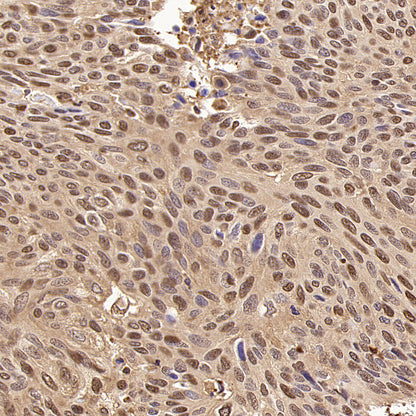 S-RMab® GAPDH Recombinant Rabbit mAb (S-240-147)