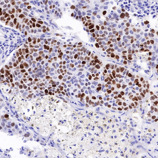 Topoisomerase II alpha Recombinant Rabbit mAb (S-513-7)