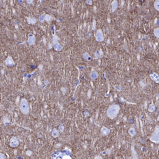 SLIT2 Recombinant Rabbit mAb (S-730-41)
